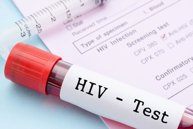 Sau phơi nhiễm với HIV, khi nào nên đi xét nghiệm?