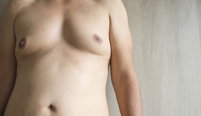 Các dấu hiệu nhận biết sớm hội chứng khiến nam giới không có tinh trùng