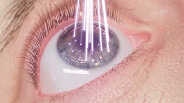 Cách kiểm soát cận thị và bổ sung dưỡng chất giúp đôi mắt sáng khỏe
