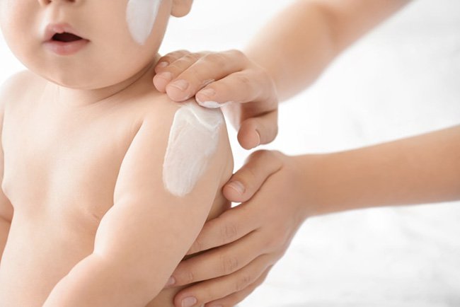 Lạm dụng thuốc chứa corticoid chữa bệnh ngoài da ở trẻ có thể gây teo da, tăng nguy cơ nhiễm khuẩn