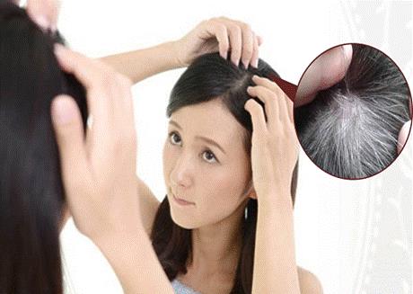 Các biện pháp dưỡng sinh chữa tóc bạc sớm