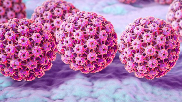 Khám sức khỏe định kỳ để phát hiện sớm tổn thương do nhiễm virus HPV, ngừa nguy cơ ung thư