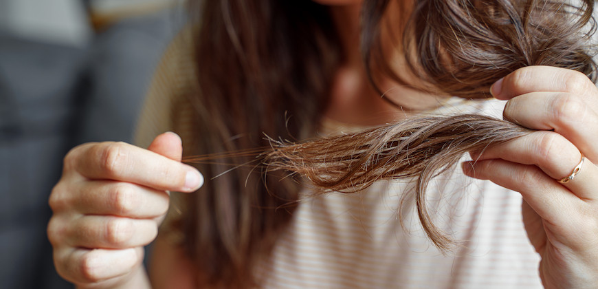 Rụng tóc mùa thu, khắc phục thế nào?