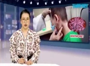 Xuất hiện 3 ca bệnh whitmore tại Thanh Hóa và Đắk Lắk