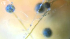Soi nấm mốc dưới kính hiển vi (phần 2)