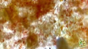 Soi ớt xay dưới kính hiển vi (phần 2)